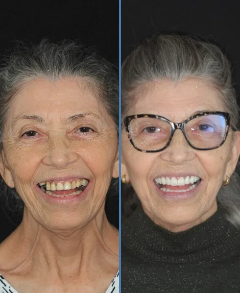 Antes e depois